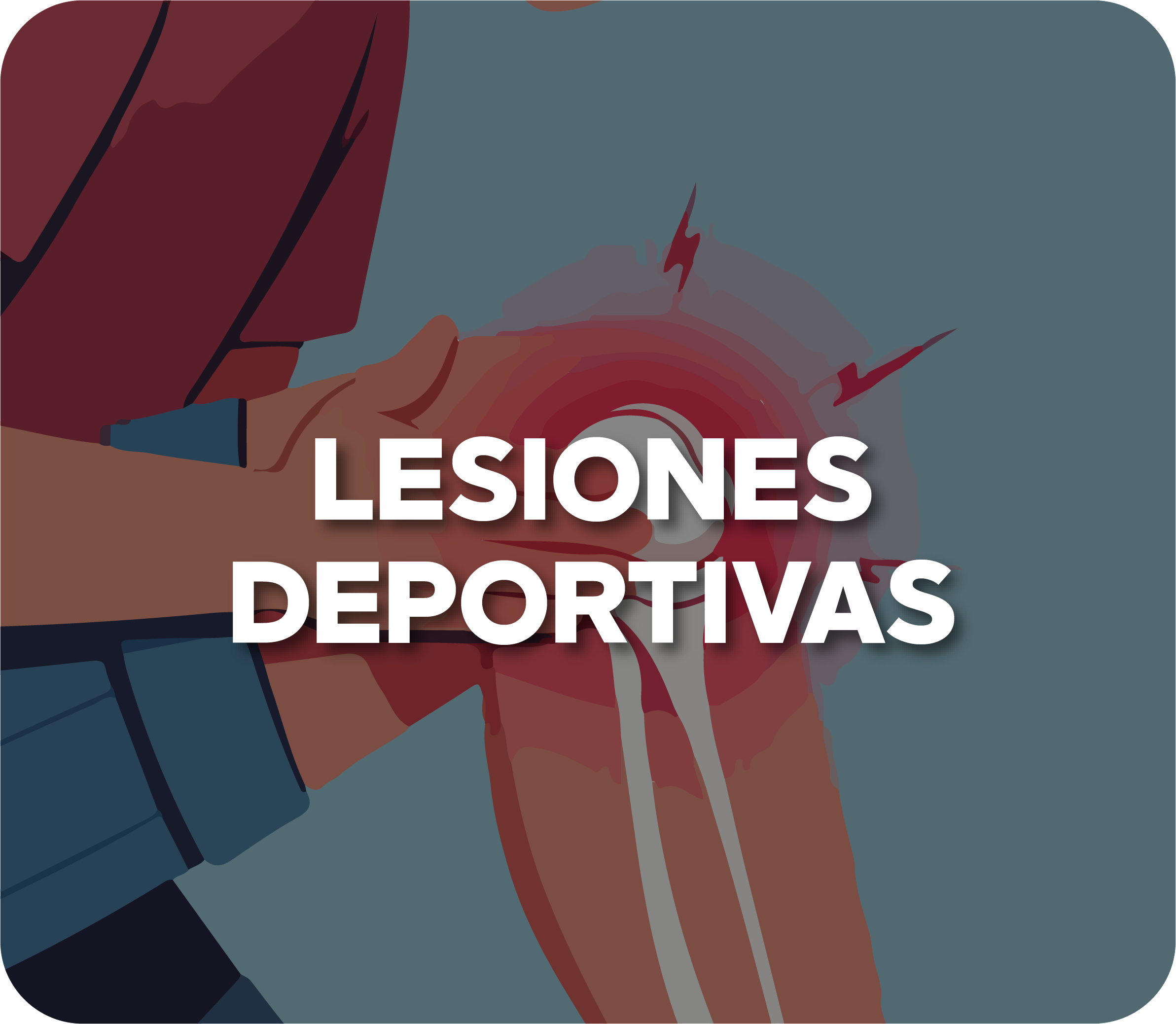 Luxación de hombro